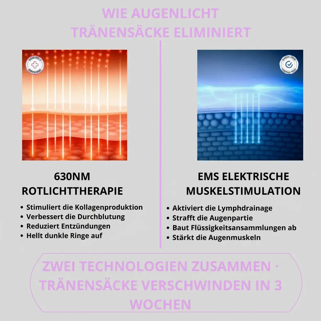 AugenLicht® – Rotlicht-Therapie gegen Augenringe & Tränensäcke