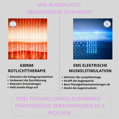 AugenLicht® – Rotlicht-Therapie gegen Augenringe & Tränensäcke