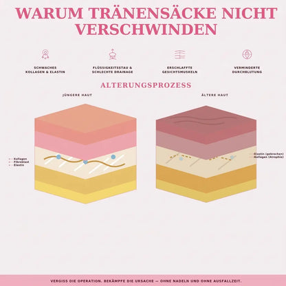 AugenLicht® – Rotlicht-Therapie gegen Augenringe & Tränensäcke